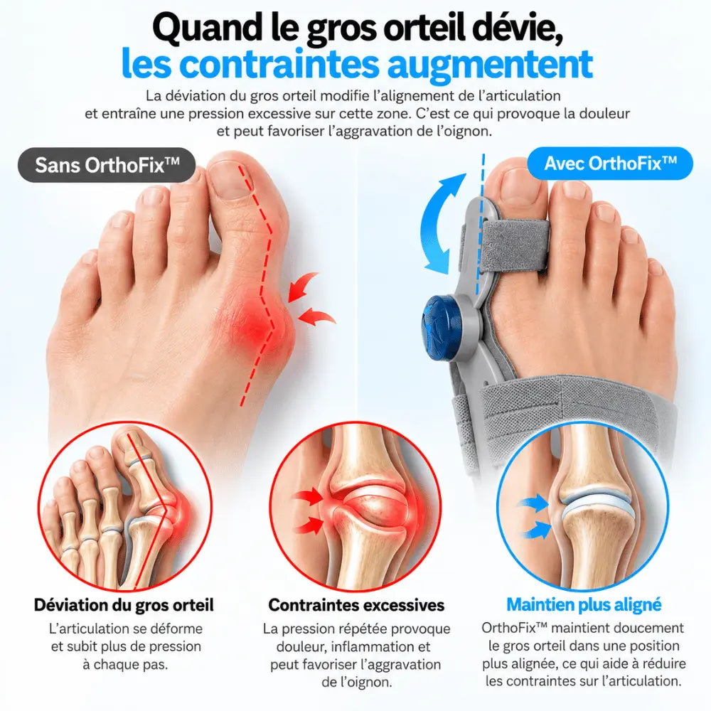 OrthoFix™ — Soulagez votre hallux valgus. Aidez à freiner son aggravation