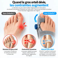 OrthoFix™ — Soulagez votre hallux valgus. Aidez à freiner son aggravation