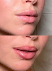 Peel Of Lip Liner – StayLine
