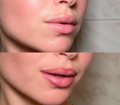 Peel Of Lip Liner – StayLine